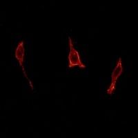 GPR40 Rabbit Polyclonal Antibody