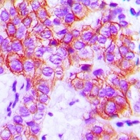 Focal Adhesion Kinase Rabbit Polyclonal Antibody