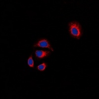 Focal Adhesion Kinase Rabbit Polyclonal Antibody