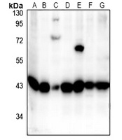p38 Antibody [KO/KD Validated]