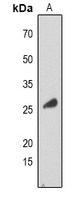 RAB34 Antibody