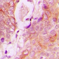 RAB34 Antibody