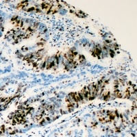 RRS1 Antibody