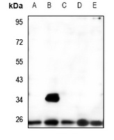 MRRF Rabbit Polyclonal Antibody