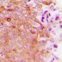 MRRF Rabbit Polyclonal Antibody