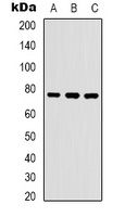 WASF1 (Phospho-Y125) Rabbit Polyclonal Antibody