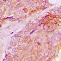 WASF1 (Phospho-Y125) Rabbit Polyclonal Antibody