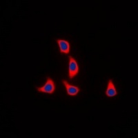 WASF1 (Phospho-Y125) Rabbit Polyclonal Antibody