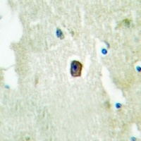 HER3 (Phospho-Y1289) Rabbit Polyclonal Antibody