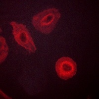 HER3 (Phospho-Y1289) Rabbit Polyclonal Antibody