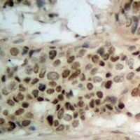 WWOX (Phospho-Y33) Rabbit Polyclonal Antibody