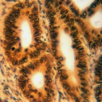 YBX1 (Phospho-S102) Antibody