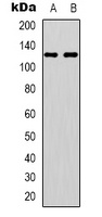 EPHA4 (Phospho-Y596) Rabbit Polyclonal Antibody