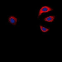 GAB1 Rabbit Polyclonal Antibody