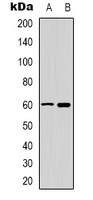 CaMK4 Rabbit Polyclonal Antibody