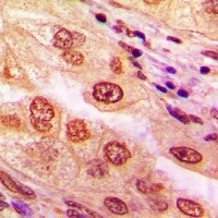 CaMK4 Rabbit Polyclonal Antibody