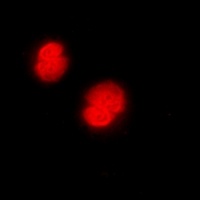 CaMK4 Rabbit Polyclonal Antibody