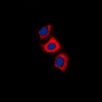 Recoverin Antibody