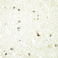 BUD31 Rabbit Polyclonal Antibody