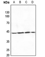 MKK4 Rabbit Polyclonal Antibody