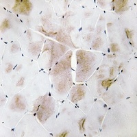 MKK4 Rabbit Polyclonal Antibody