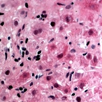 Glycerol Kinase 1 Rabbit Polyclonal Antibody