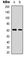 YTHDF1 Antibody