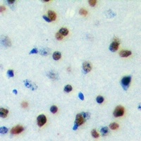 DYRK1B Rabbit Polyclonal Antibody