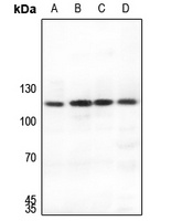 SUPT16H Rabbit Polyclonal Antibody