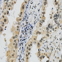 SUPT16H Rabbit Polyclonal Antibody