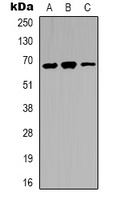 IRAK3 Antibody