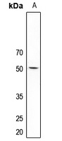 5-HT2C Rabbit Polyclonal Antibody