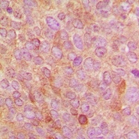 Cytochrome P450 24A1 Antibody