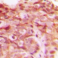 DNAJB4 Rabbit Polyclonal Antibody