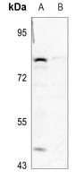 GSPT1 Rabbit Polyclonal Antibody