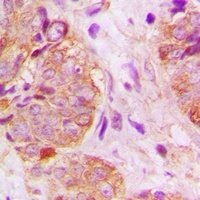 GSPT1 Rabbit Polyclonal Antibody