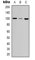 MSH2 Rabbit Polyclonal Antibody