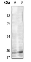 MRPL22 Rabbit Polyclonal Antibody