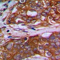 MRPL22 Rabbit Polyclonal Antibody