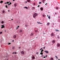 CEP131 Rabbit Polyclonal Antibody