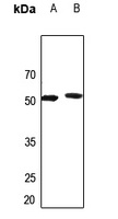 AGXT2L2 Rabbit Polyclonal Antibody