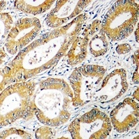 AGXT2L2 Rabbit Polyclonal Antibody