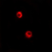 Arylsulfatase I Antibody