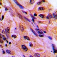 CDC42EP4 Rabbit Polyclonal Antibody