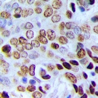 POLR3E Rabbit Polyclonal Antibody