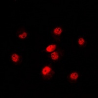 POLR3E Rabbit Polyclonal Antibody