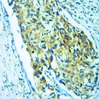 HCN2 Rabbit Polyclonal Antibody