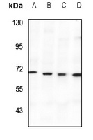 SPAK Rabbit Polyclonal Antibody