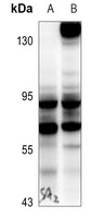 BAG3 Rabbit Polyclonal Antibody
