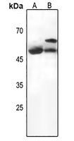 Serpin A3 Rabbit Polyclonal Antibody